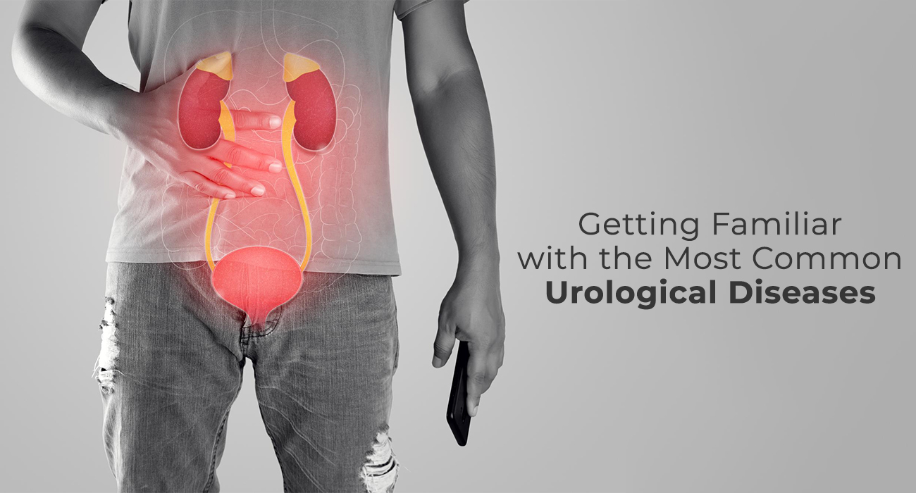 Getting Familiar with the Most Common Urological Diseases